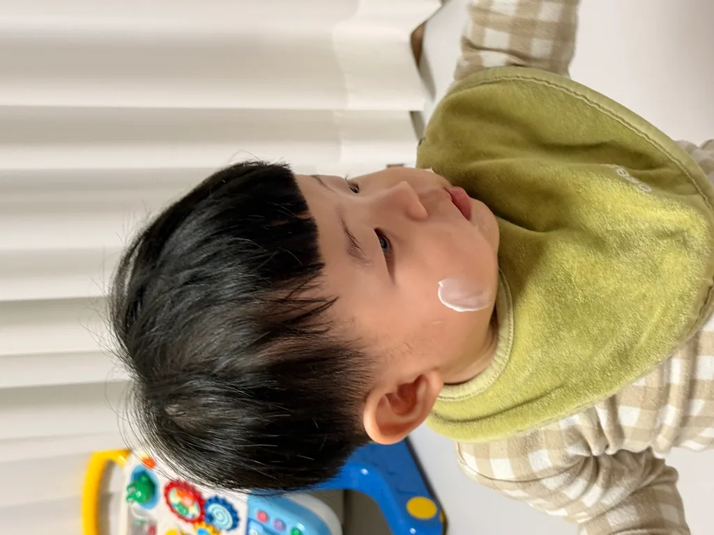 좁쌀 같은 작은 점이 여러 개, 땀띠·여드름·수족구 어떻게 구분할까요